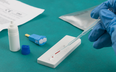Test kasetowy na obecność koronawirusa SARS-CoV-2