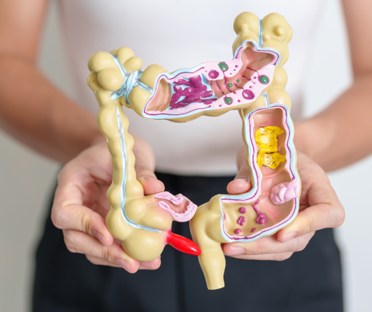 Profilaktyka raka jelita grubego profilaktyka_jelita