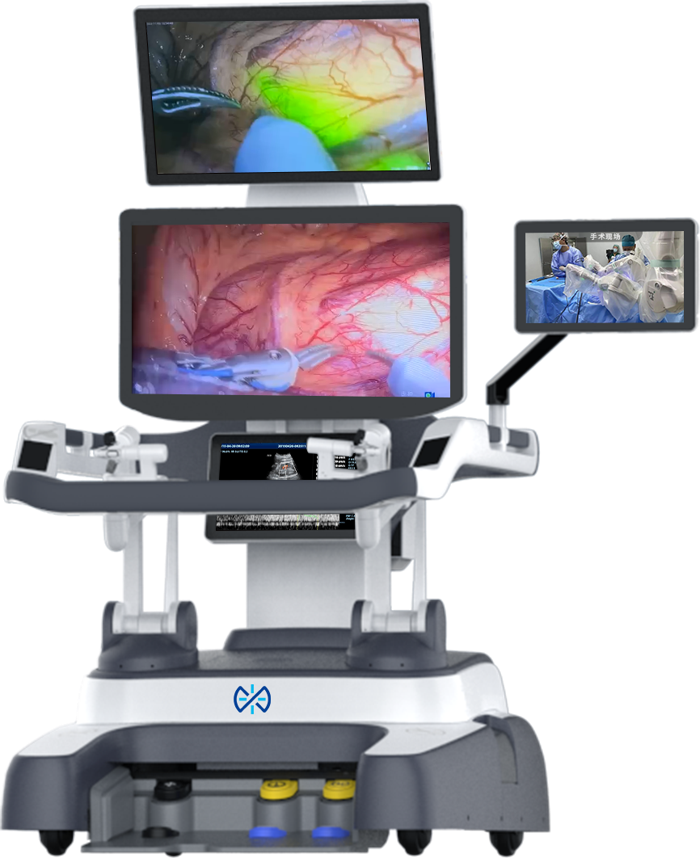 Robot medyczny chirurgiczny KangDuo SR2000 podczas zabiegu laparoskopowego